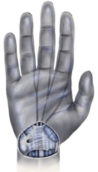 istock_000019415236xsmall.jpg